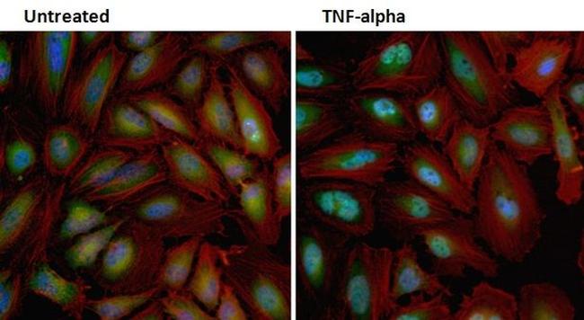 NFkB p65 Antibody