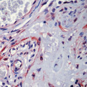 NFkB p65 Antibody in Immunohistochemistry (Paraffin) (IHC (P))