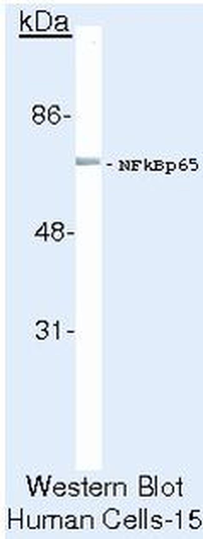 NFkB p65 Antibody in Western Blot (WB)