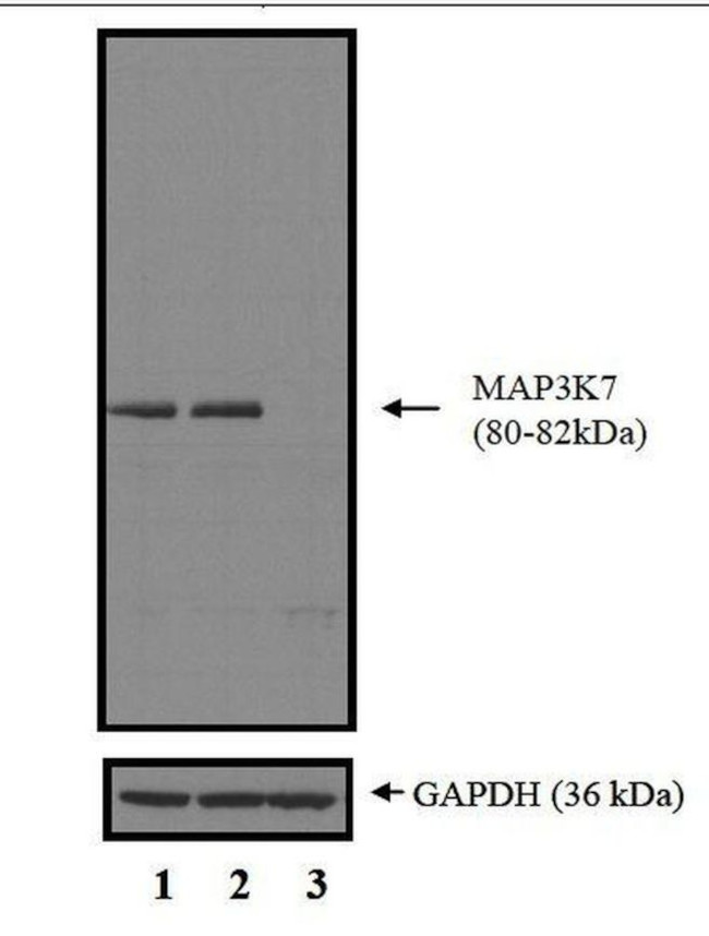 TAK1 Antibody