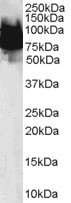 KLF4 Antibody in Western Blot (WB)