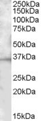 BTLA Antibody in Western Blot (WB)