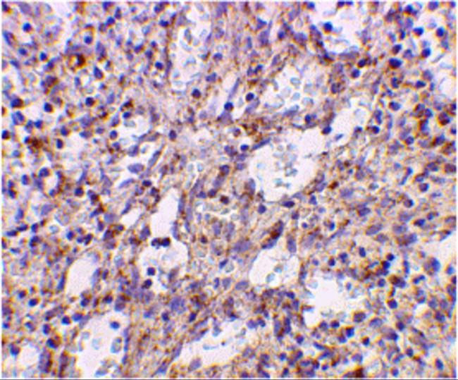 TLR2 Antibody in Immunohistochemistry (IHC)