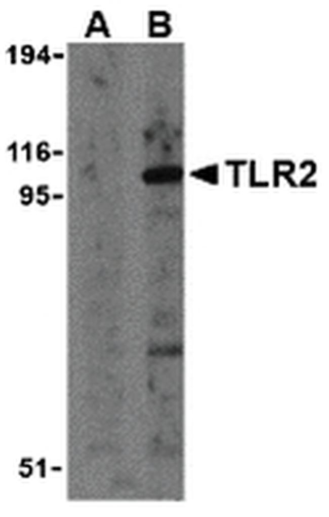 TLR2 Antibody in Western Blot (WB)