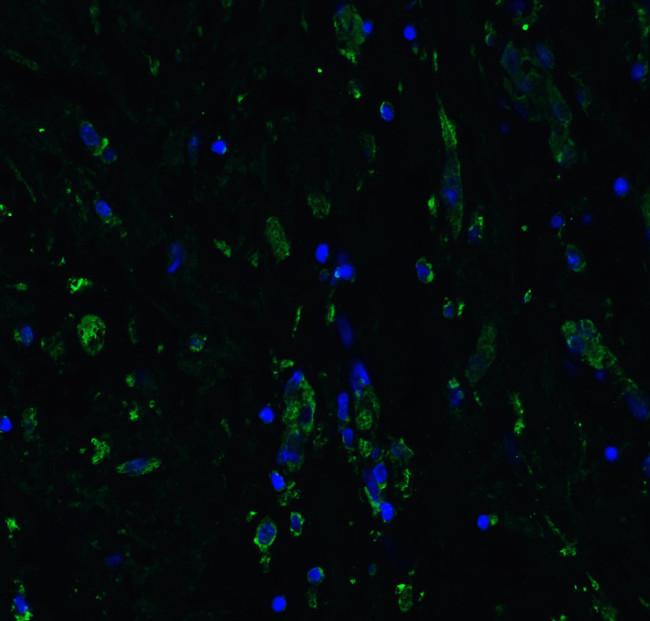 ACE2 Antibody in Immunohistochemistry (PFA fixed) (IHC (PFA))