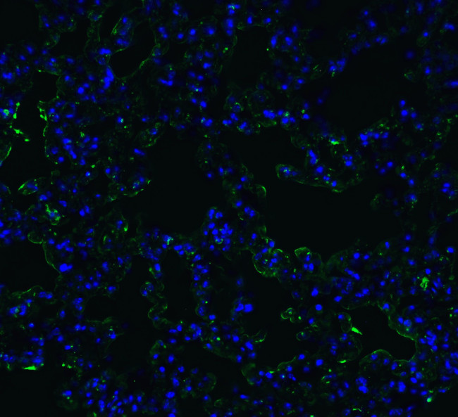 ACE2 Antibody in Immunohistochemistry (PFA fixed) (IHC (PFA))