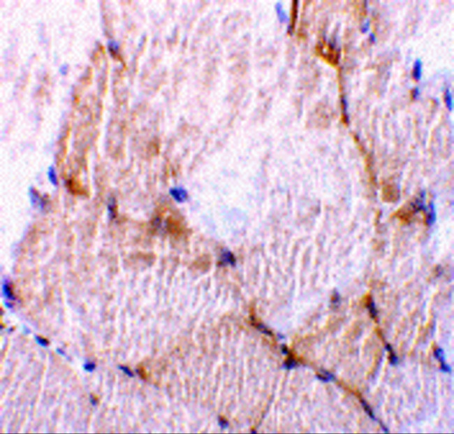 Caspase 7 Antibody in Immunohistochemistry (IHC)