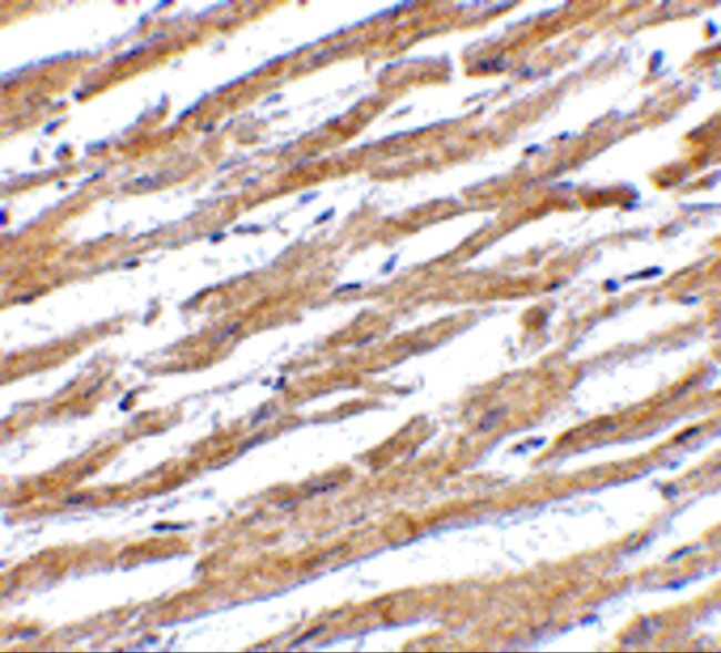 PD-L1 Antibody in Immunohistochemistry (Paraffin) (IHC (P))