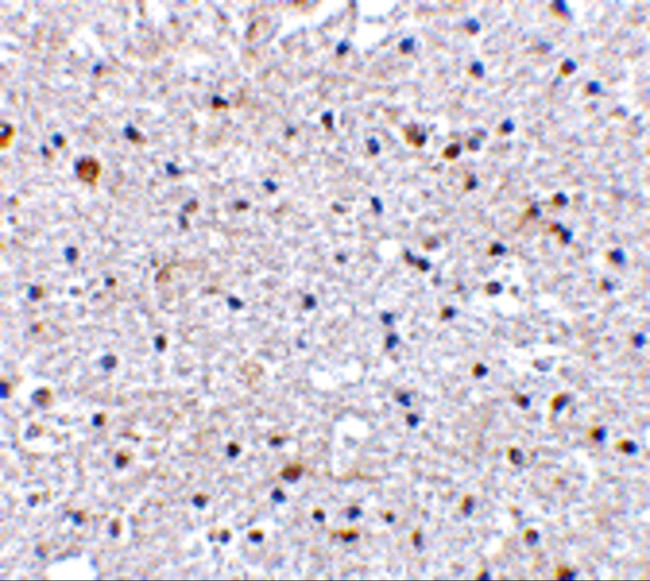 PD-1 Antibody in Immunohistochemistry (Paraffin) (IHC (P))