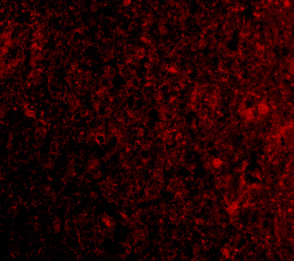 PD-1 Antibody in Immunohistochemistry (Paraffin) (IHC (P))