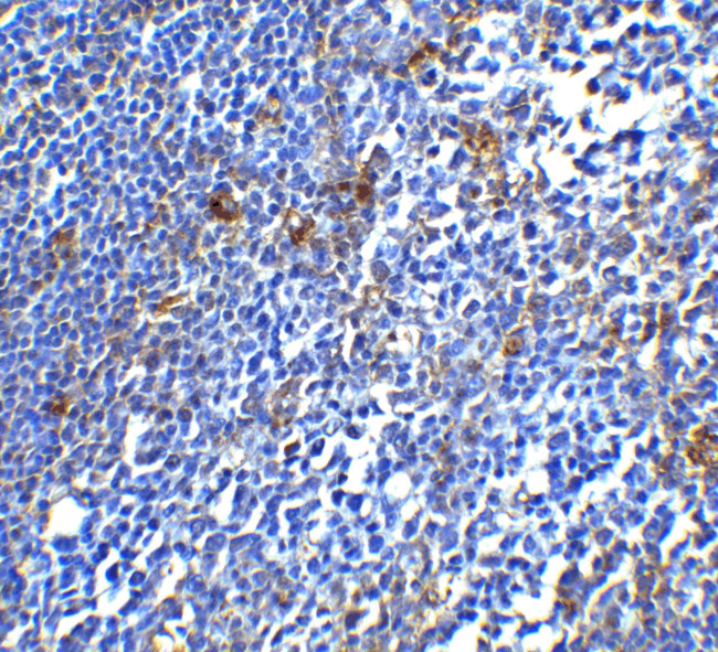 PD-1 Antibody in Immunohistochemistry (Paraffin) (IHC (P))