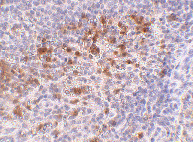 Cathelicidin Antibody in Immunohistochemistry (IHC)