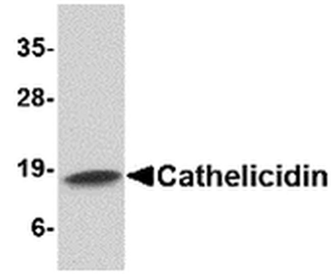 Cathelicidin Antibody in Western Blot (WB)