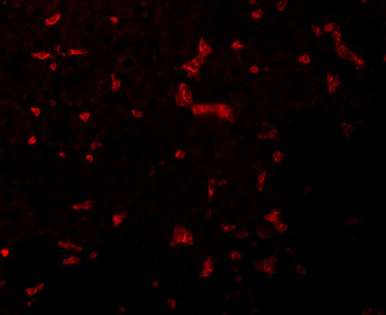 RIP1 Antibody in Immunocytochemistry (ICC/IF)