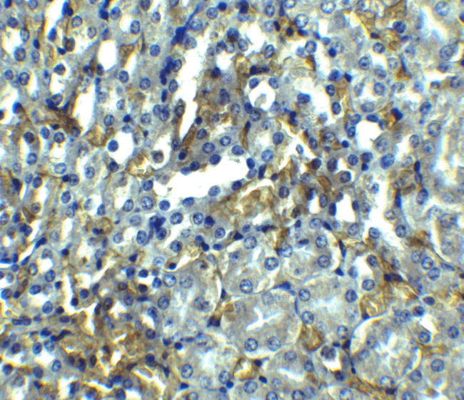 RIP1 Antibody in Immunohistochemistry (IHC)