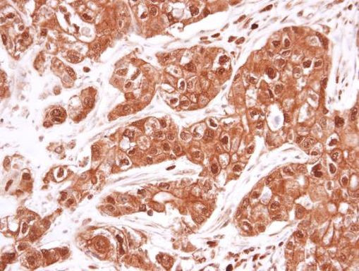 VCP Antibody in Immunohistochemistry (Paraffin) (IHC (P))