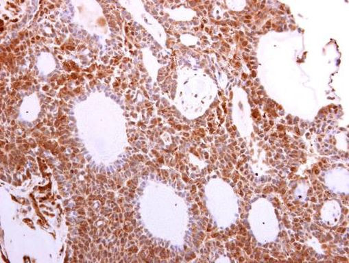 VCP Antibody in Immunohistochemistry (Paraffin) (IHC (P))