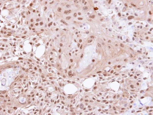 VCP Antibody in Immunohistochemistry (Paraffin) (IHC (P))