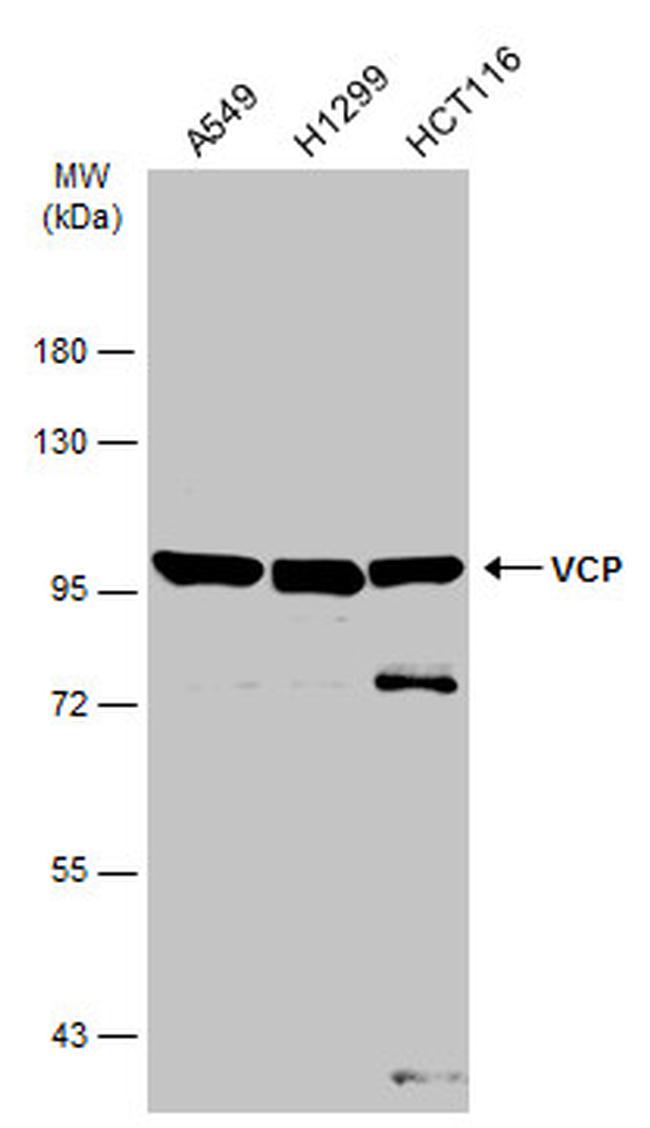 VCP Antibody in Western Blot (WB)