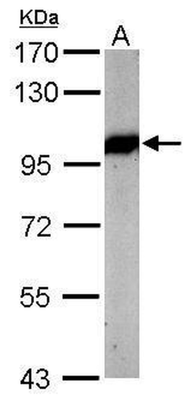 VCP Antibody in Western Blot (WB)