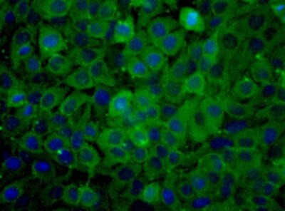 PKM2 Antibody in Immunocytochemistry (ICC/IF)