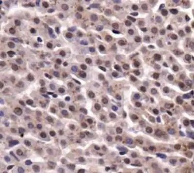 PKM2 Antibody in Immunohistochemistry (Paraffin) (IHC (P))