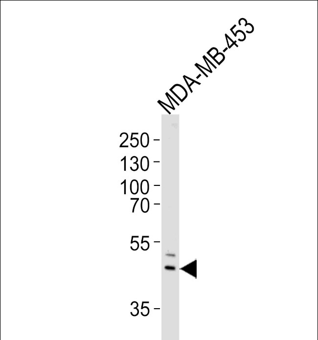 IL5RA Antibody in Western Blot (WB)