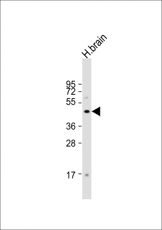 FOXG1 Antibody in Western Blot (WB)