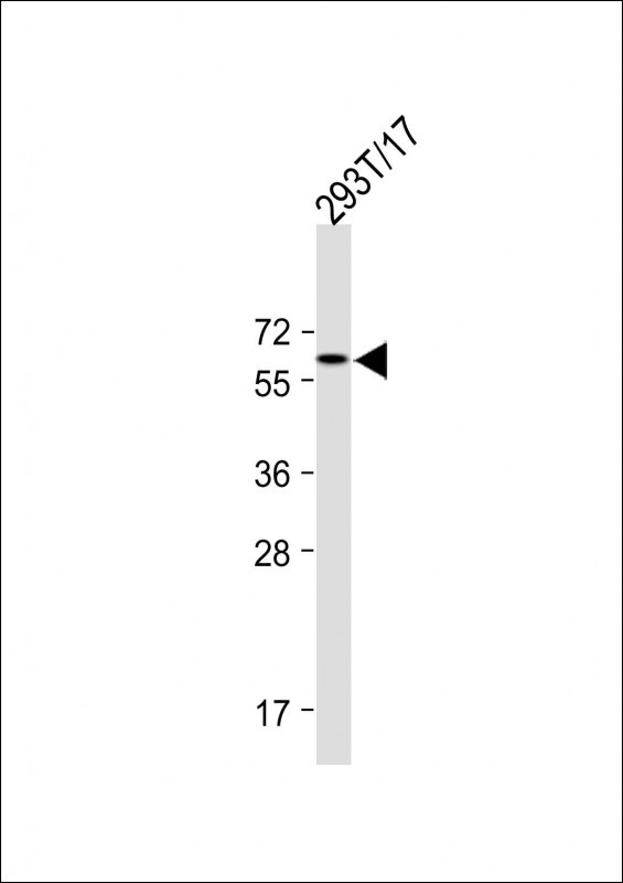 FOXG1 Antibody in Western Blot (WB)