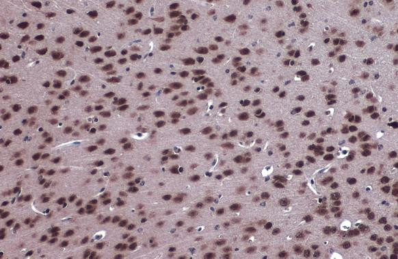 FOXO3A Antibody in Immunohistochemistry (Paraffin) (IHC (P))