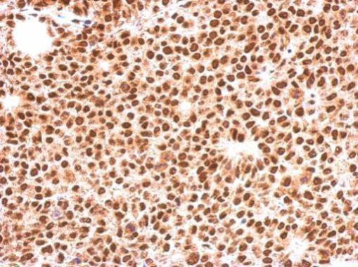 FOXO3A Antibody in Immunohistochemistry (Paraffin) (IHC (P))