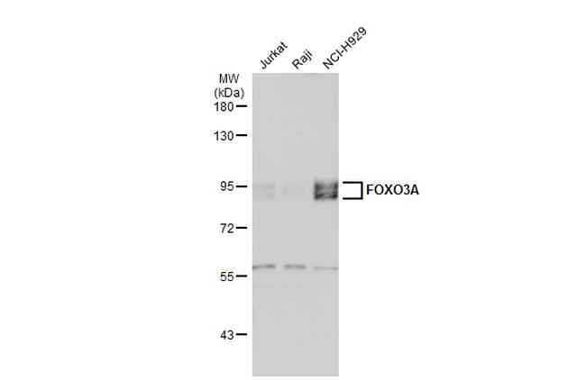 FOXO3A Antibody in Western Blot (WB)