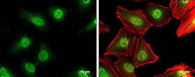 p27 Kip1 Antibody in Immunocytochemistry (ICC/IF)