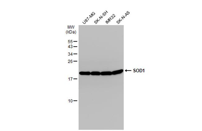 SOD1 Antibody in Western Blot (WB)