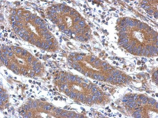 Angiopoietin 2 Antibody in Immunohistochemistry (Paraffin) (IHC (P))