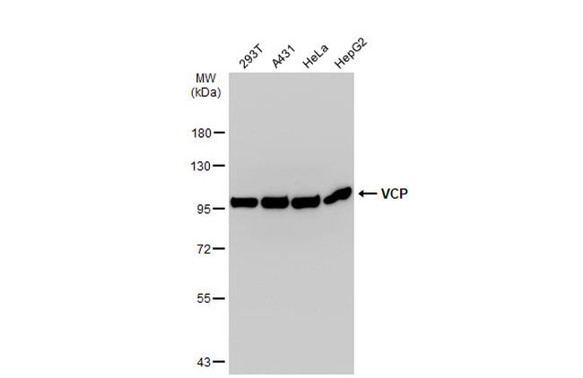 VCP Antibody in Western Blot (WB)