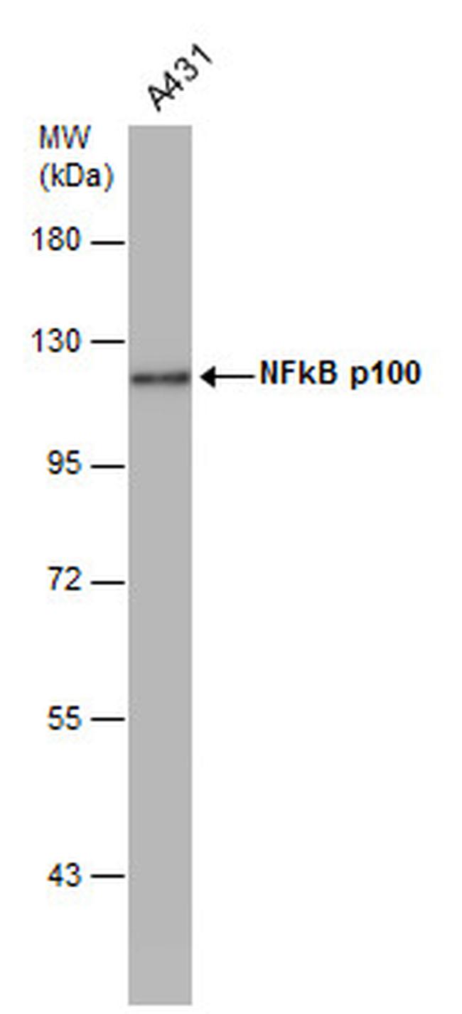 NFkB p100 Antibody in Western Blot (WB)