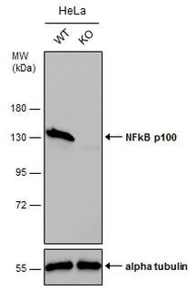 NFkB p100 Antibody