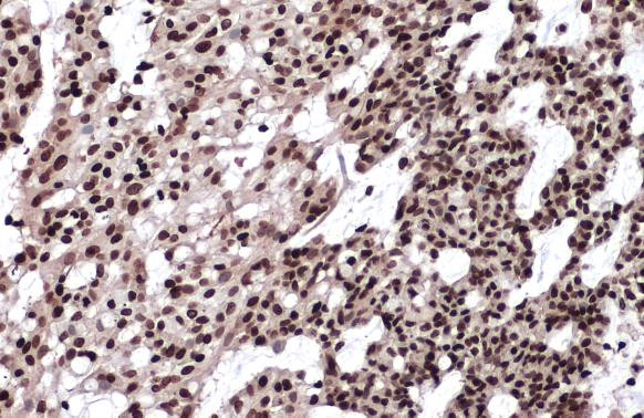 Histone H2A.X Antibody in Immunohistochemistry (Paraffin) (IHC (P))