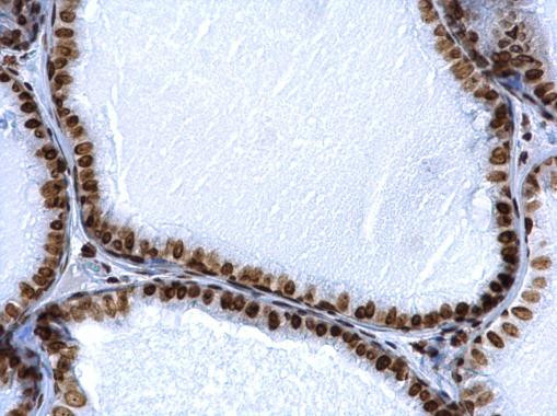 Histone H2A.X Antibody in Immunohistochemistry (Paraffin) (IHC (P))