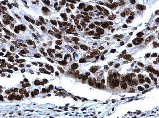 Histone H2A.X Antibody in Immunohistochemistry (Paraffin) (IHC (P))