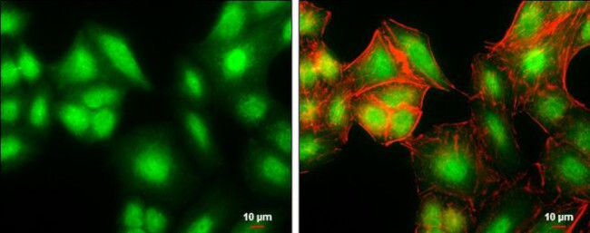 CHOP Antibody in Immunocytochemistry (ICC/IF)