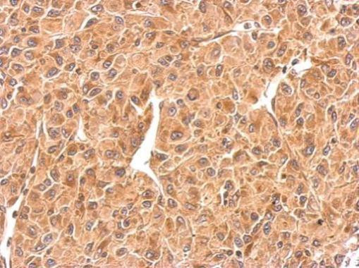 RAB5 Antibody in Immunohistochemistry (Paraffin) (IHC (P))