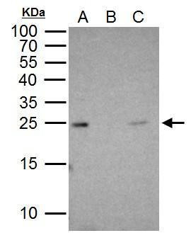 RAB5 Antibody in Immunoprecipitation (IP)