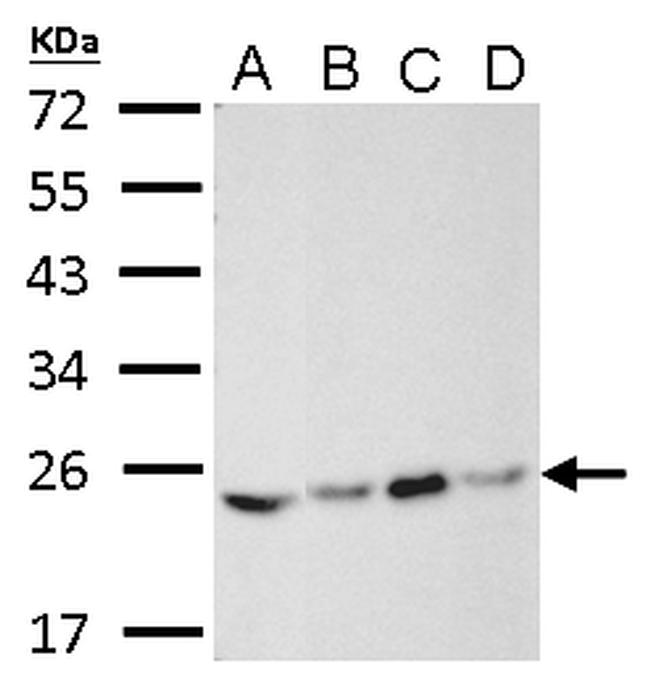 RAB5 Antibody in Western Blot (WB)