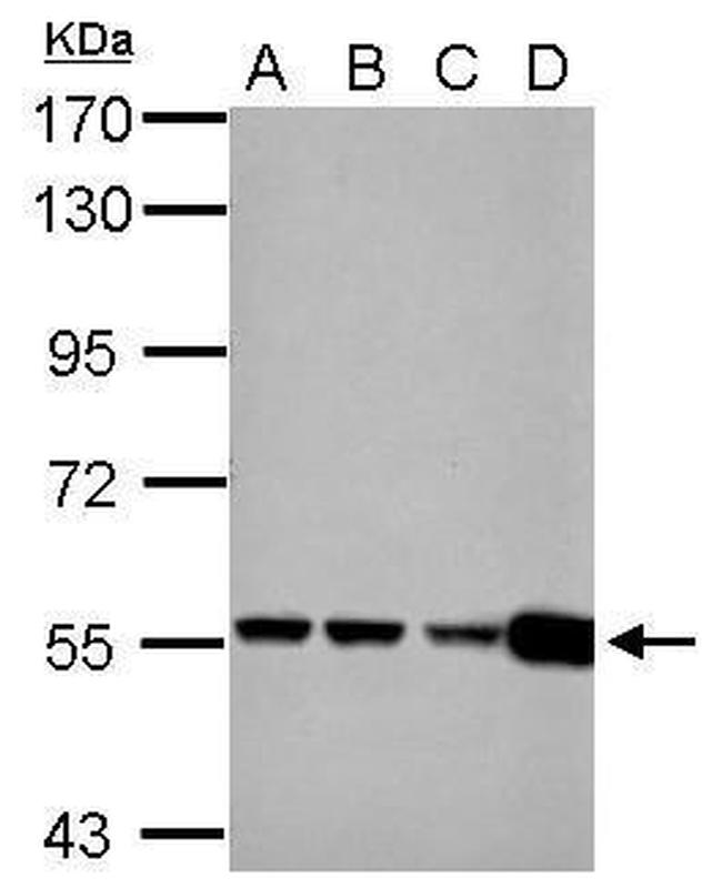 GluD1/GluD2 Antibody in Western Blot (WB)