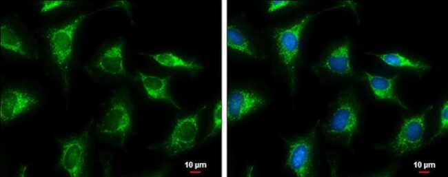 GluD1/GluD2 Antibody in Immunocytochemistry (ICC/IF)