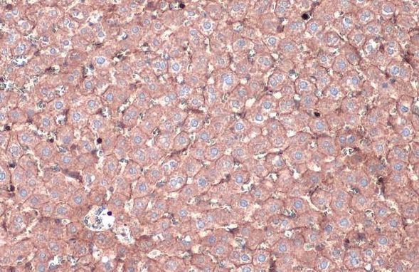 N-cadherin Antibody in Immunohistochemistry (Paraffin) (IHC (P))