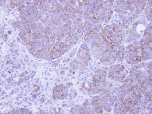 AIF Antibody in Immunohistochemistry (Paraffin) (IHC (P))