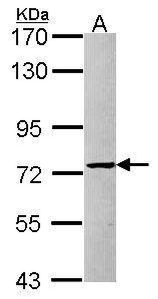 PRMT5 Antibody in Western Blot (WB)